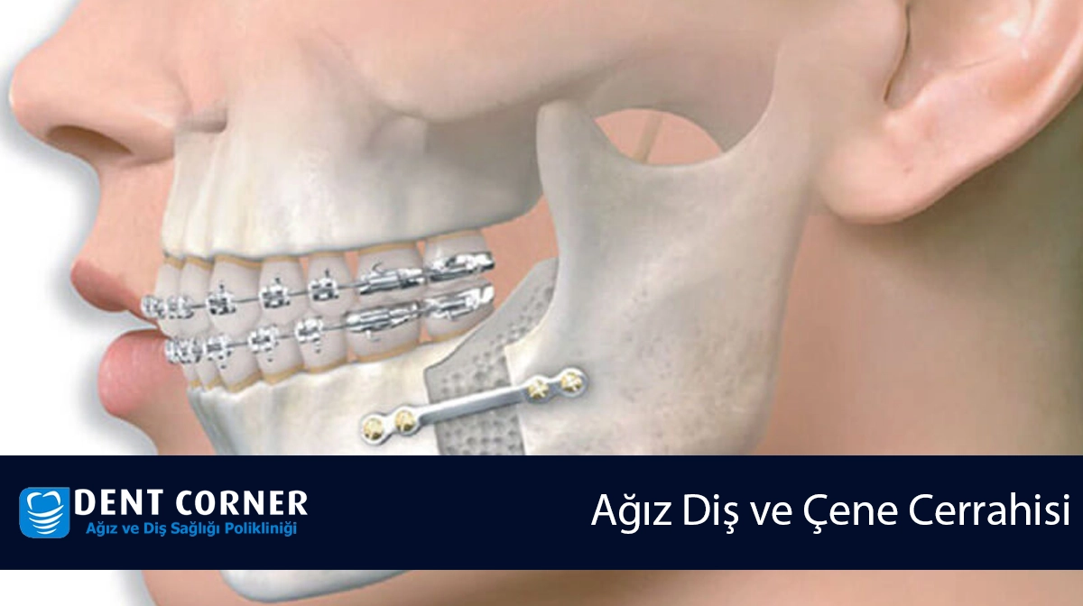 Ağız Diş ve Çene Cerrahisi: Ağız ve Yüz Sağlığınız İçin Hayati Bir Alan