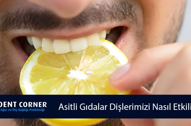 Asitli Gıdalar Dişlerimizi Nasıl Etkiliyor? Dikkat Etmemiz Gerekenler