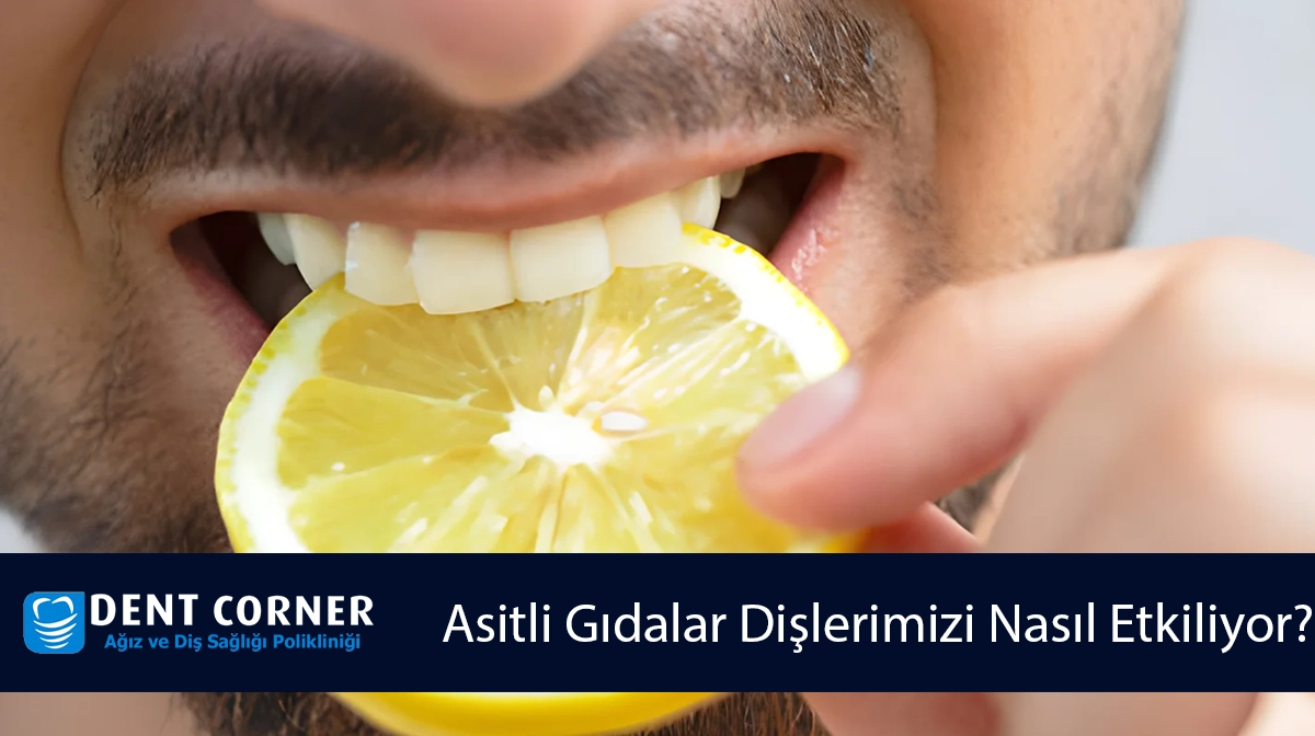 Asitli Gıdalar Dişlerimizi Nasıl Etkiliyor? Dikkat Etmemiz Gerekenler