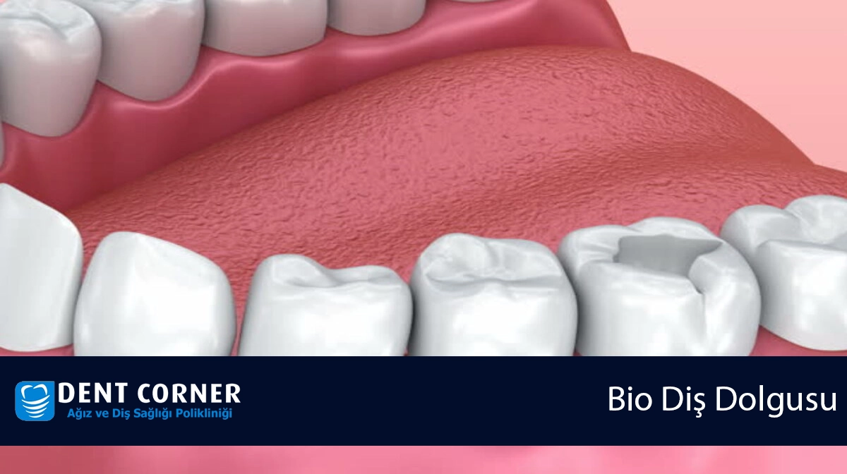 Bio Diş Dolgusu Ne Demektir?