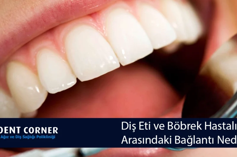 Diş Eti ve Böbrek Hastalıkları Arasındaki Bağlantı Nedir?