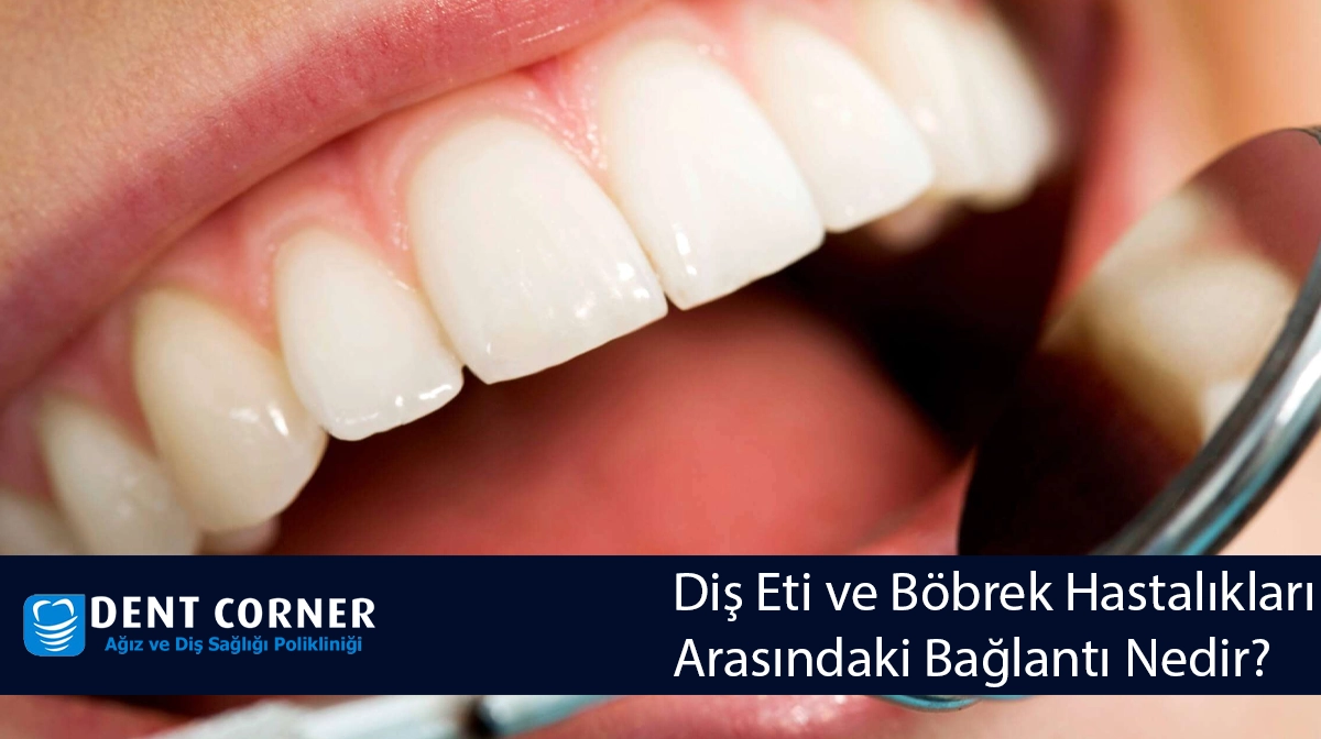 Diş Eti ve Böbrek Hastalıkları Arasındaki Bağlantı Nedir?