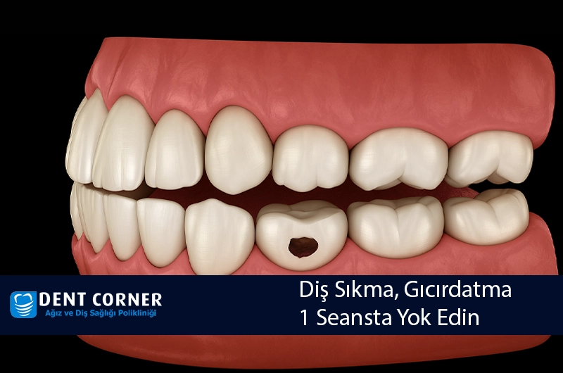 Uykuda Diş Sıkma, Gıcırdatma Çözümüne Çene Botoksu