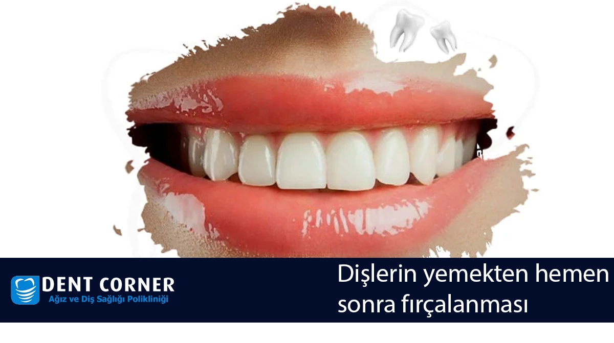 Dişlerin yemekten hemen sonra fırçalanması, Diş Sert Dokularında Aşınmaya Neden Olur