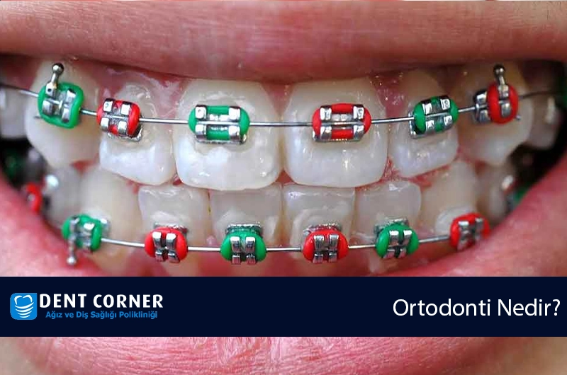 Ortodonti Nedir?