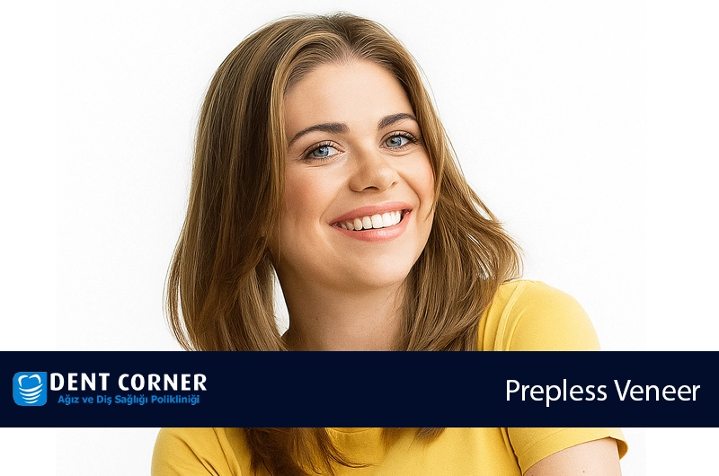 Prepless (Aşındırmasız) Veneer