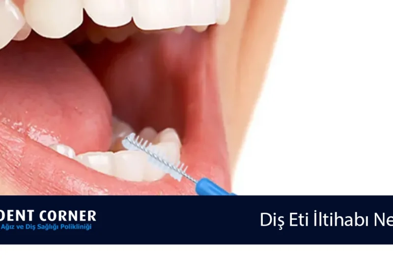 Arayüz Fırçası Nasıl ve Ne Sıklıkla Kullanılmalıdır?