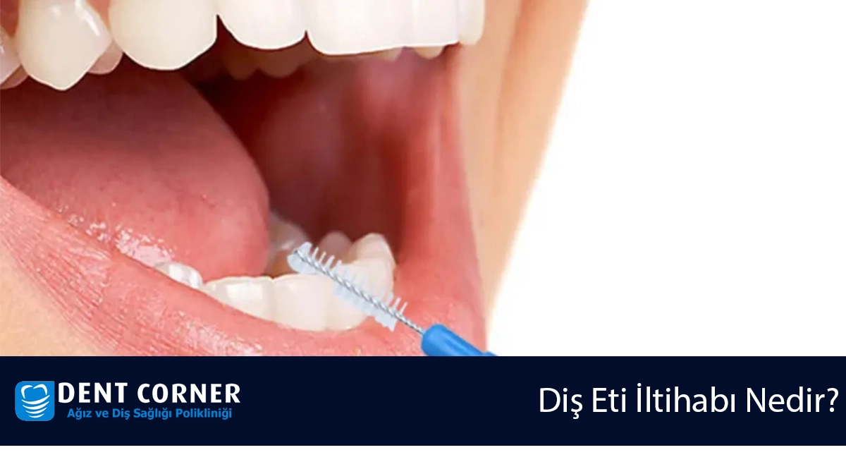 Arayüz Fırçası Nasıl ve Ne Sıklıkla Kullanılmalıdır?