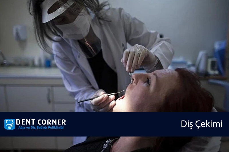 İmplant Tedavisi Öncesi ve Sonrası Neler Yapılmalıdır?