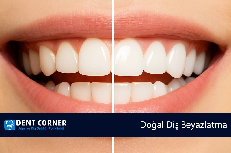 Doğal Diş Beyazlatma