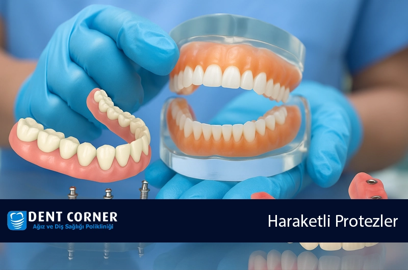Hareketli Protezler Nedir? Neden Kullanılır?