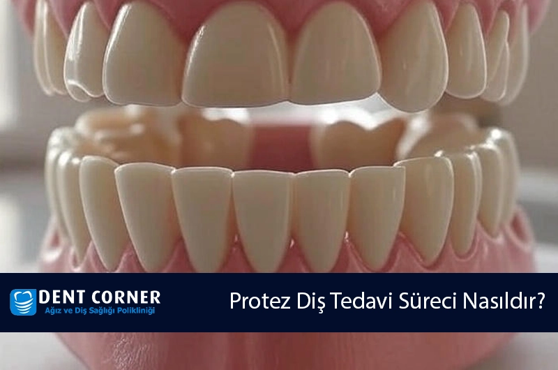 Prostodonti Nedir? Protez Diş Tedavi Süreci Nasıldır?